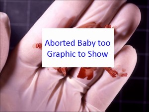 aborted-baby