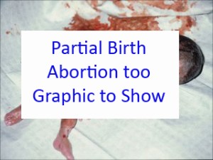 partialbirthabortion