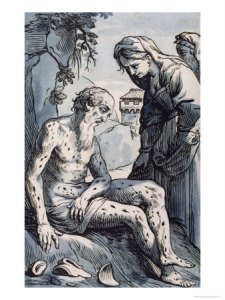 job-covered-with-sores