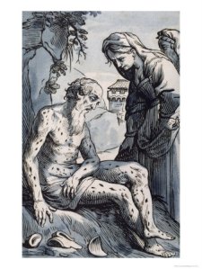 job-covered-with-sores